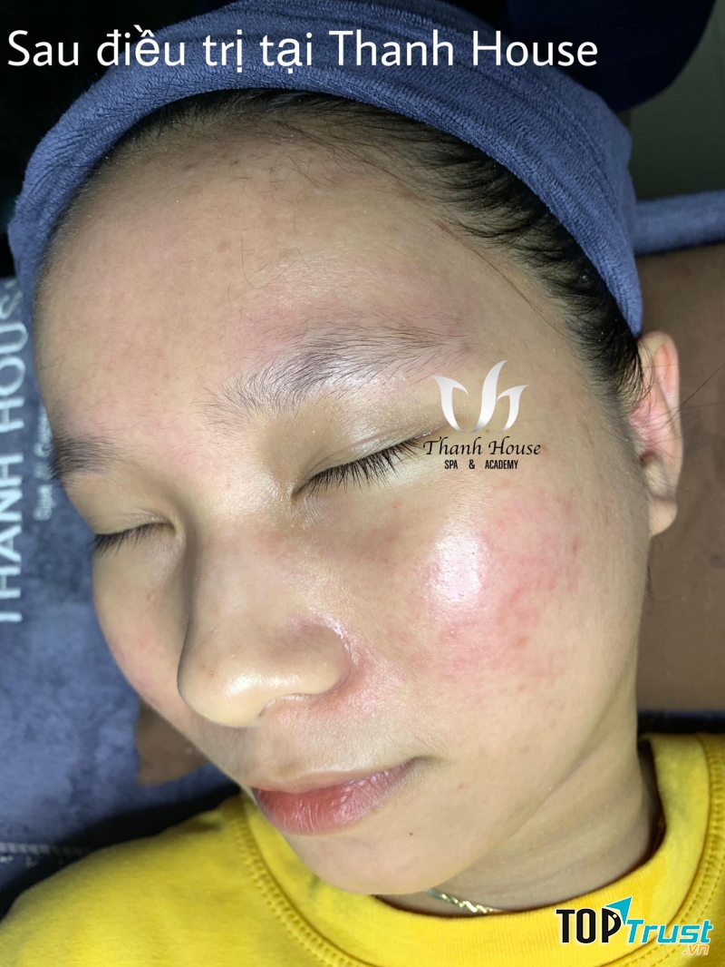 Thanh House - Spa & Academy