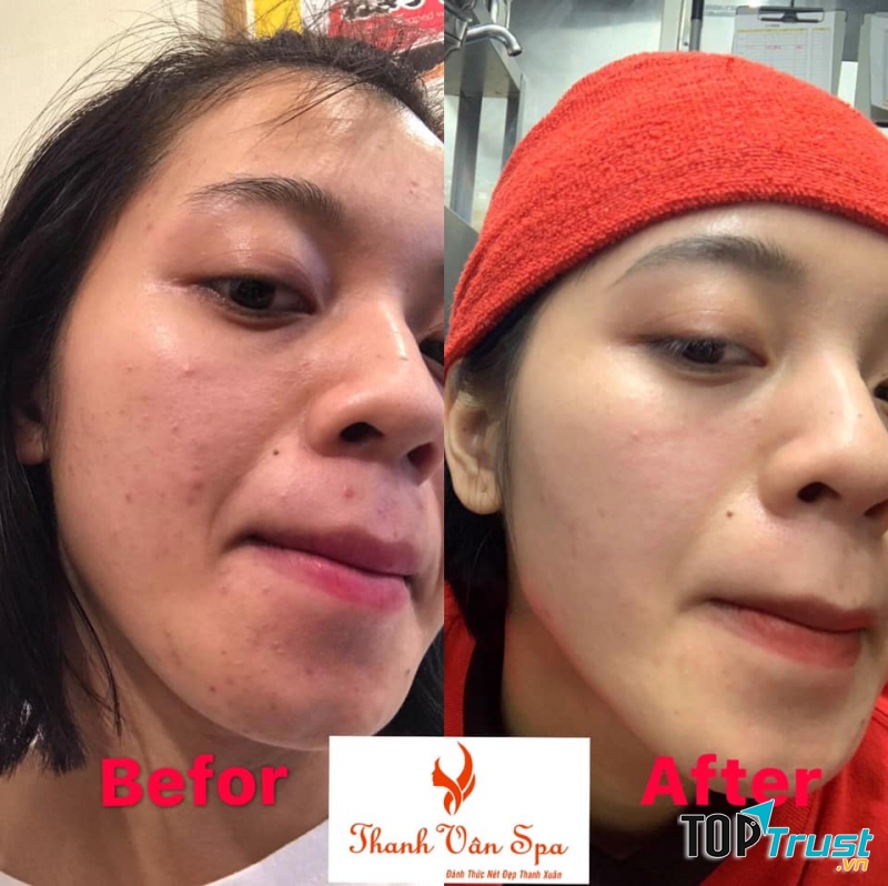 Thanh Vân Spa
