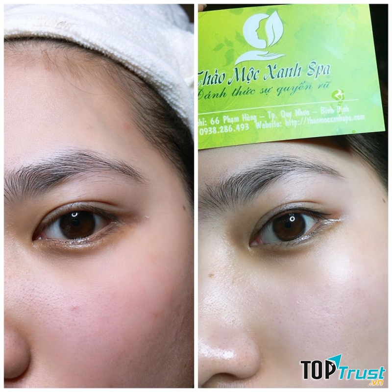 Thảo Mộc Xanh Spa & Clinic