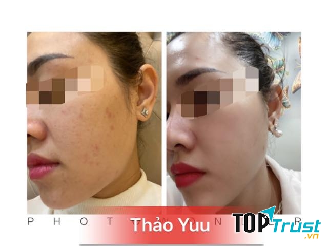 Thảo Yuu beauty & spa
