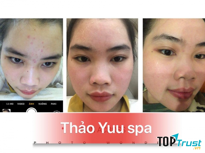Thảo Yuu Beauty & Spa