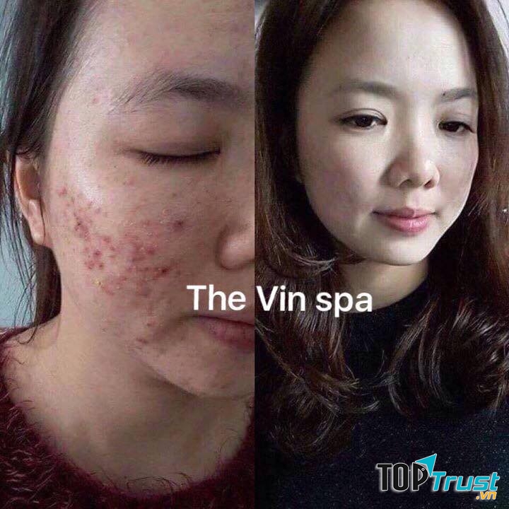 Spa Vin Đà Lạt