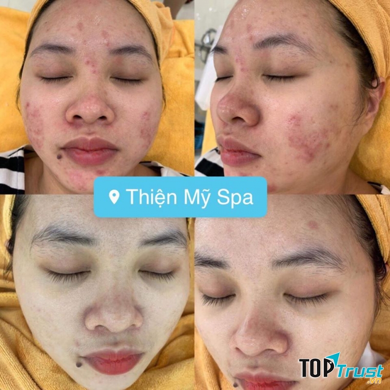 Thiện Mỹ Spa