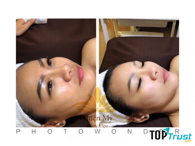 Thiện Mỹ Spa
