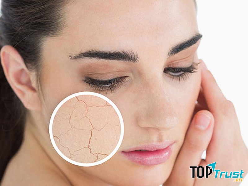 Thiếu ngủ làm vết thương trên da khó lành và da cũng dễ lão hóa hơn