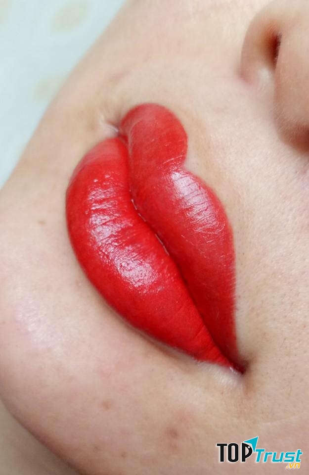 Ảnh môi khách hàng ngay sau khi phun môi vi chạm tại thẩm mỹ viện Thu Phương Spa & Beauty