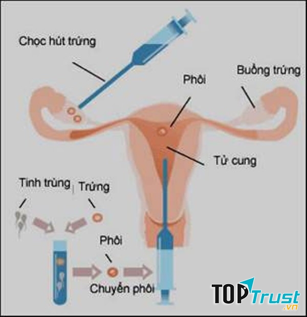 Quá trình thụ tinh ống nghiệm