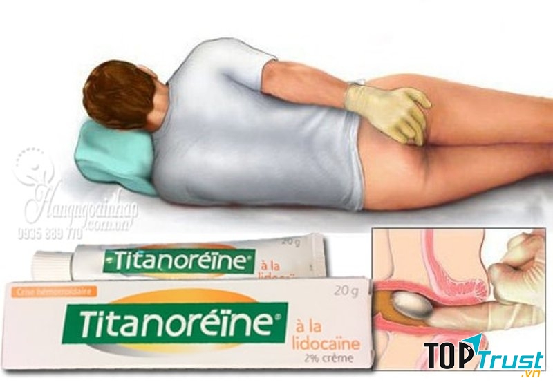 Thuốc bôi trĩ Proctolog Tube 20g