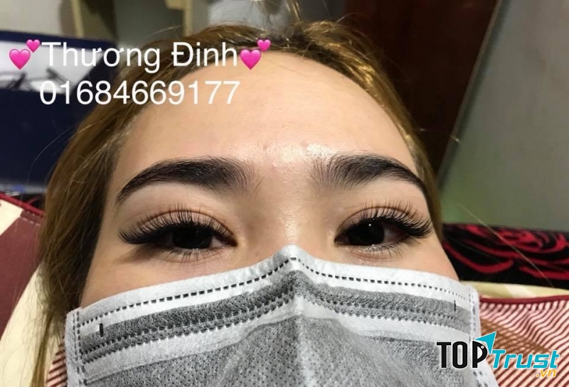 Thương Đinh Nối Mi