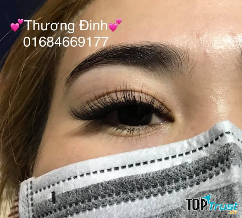 Thương Đinh Nối Mi