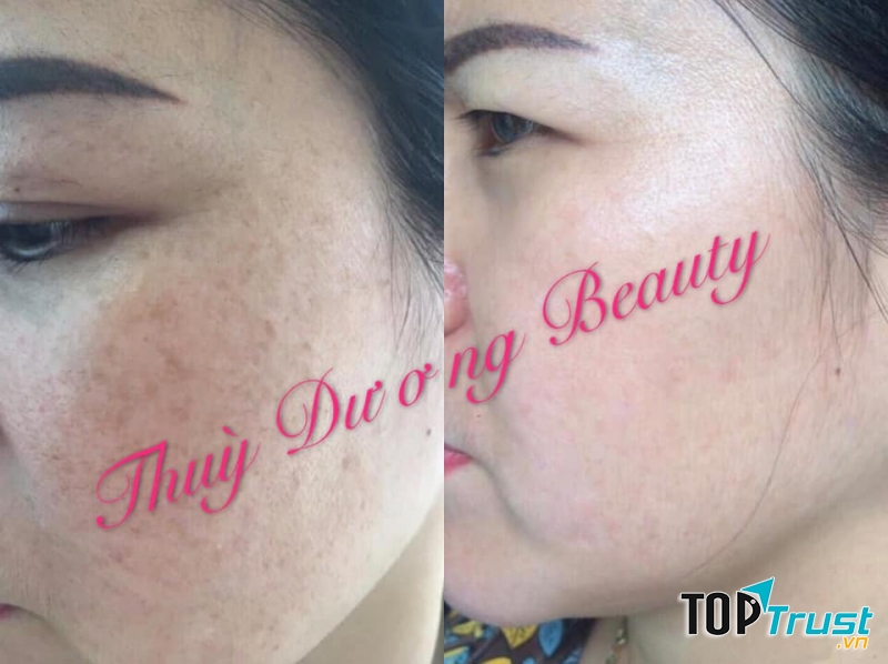 Thuỳ Dương Beauty & Spa