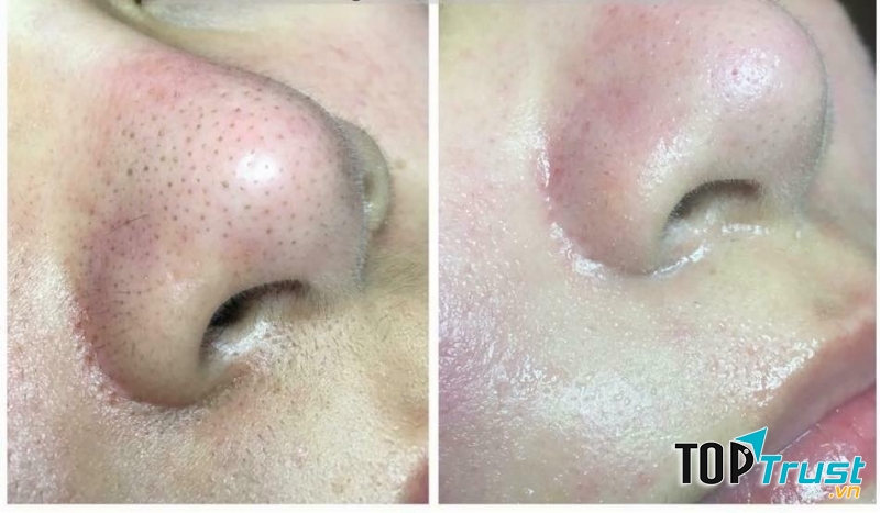 Thúy Thiên Thần Spa