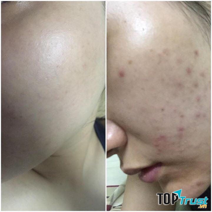 Thúy Thiên Thần Spa