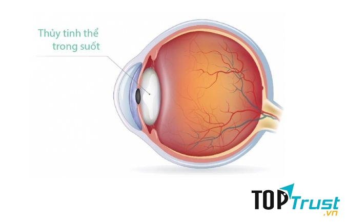 Phương pháp mới giúp những người có bệnh về mắt không phải đeo kính