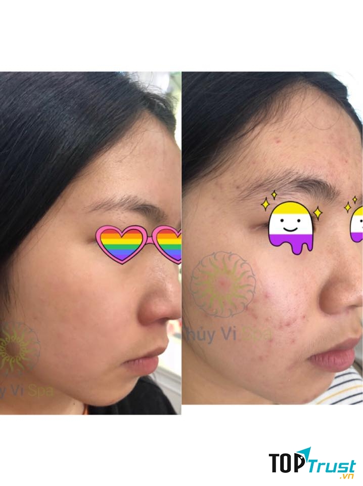 Sau hơn 6 năm thành lập, Thủy Vi Spa đã và đang khẳng định thương hiệu và trở thành địa chỉ làm đẹp tin cậy của chị em phụ nữ.