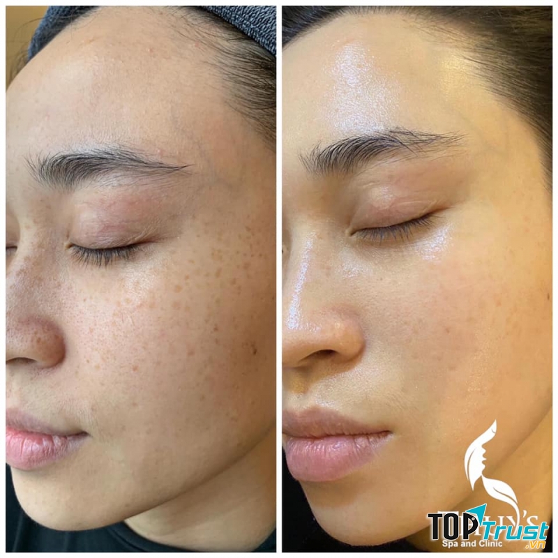 Thuy's Spa and Clinic