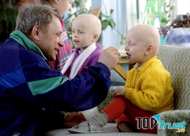 Tia phóng xạ gây dị tật ở trẻ em