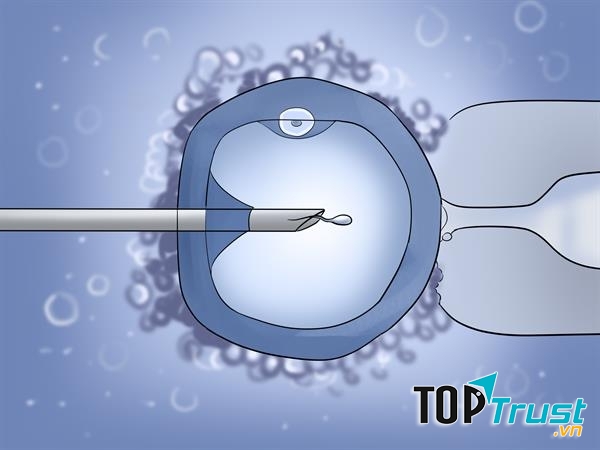 Tiêm tinh trùng vào bào tương trứng