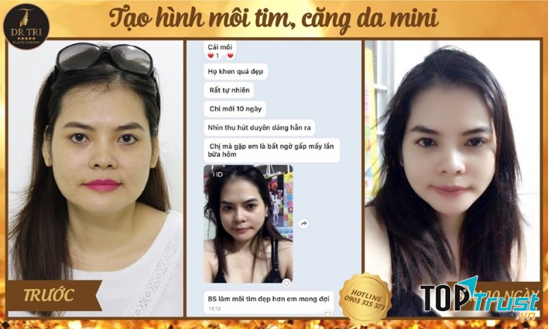 Tiến Sĩ Bác Sĩ Đỗ Thành Trí - Phẫu thuật Thẩm mỹ