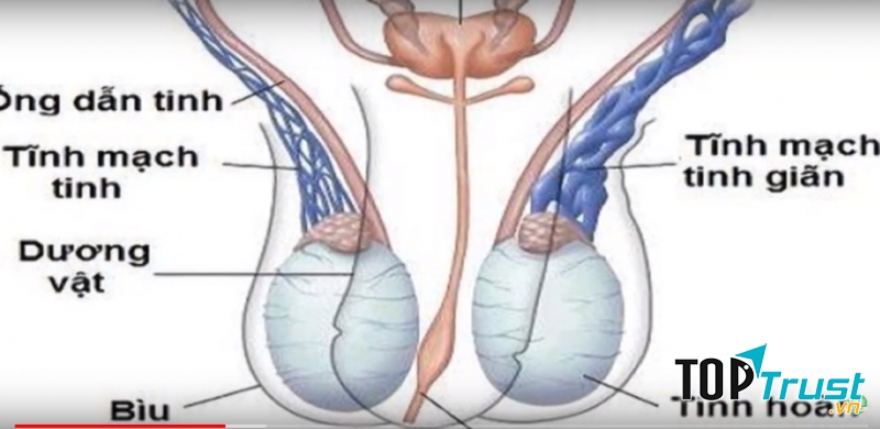 TINH HOÀN BẤT THƯỜNG