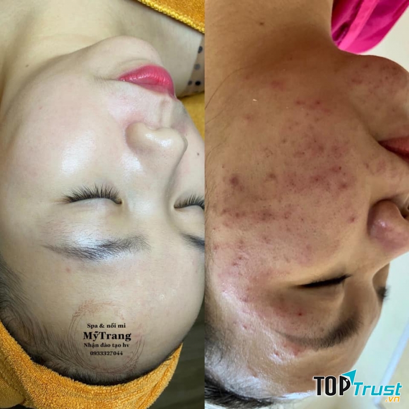 Trang Beauty Spa