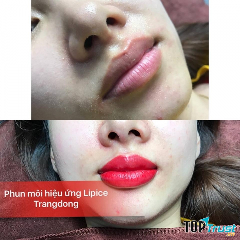Trang Đông Spa - Phun Xăm Thẩm Mỹ