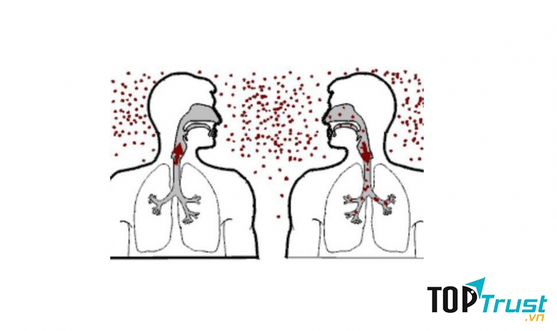 Bệnh truyền nhiễm lây lan rất nhanh nên bạn cần lưu ý.