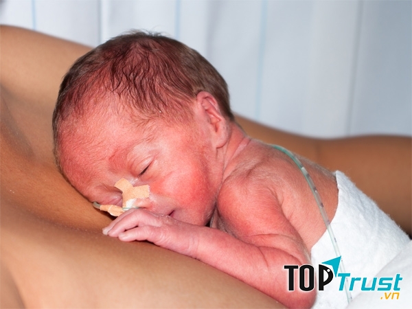 Trẻ sinh non, thiếu cân