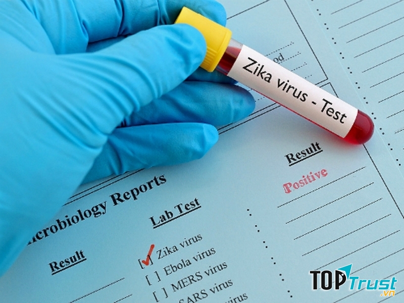 Trẻ sơ sinh có cần làm xét nghiệm virus Zika không?