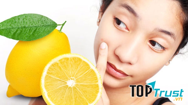 Trị mụn bằng chanh