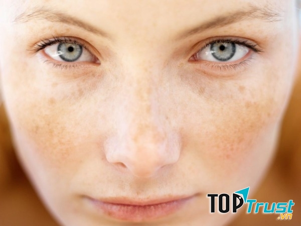 Nước ép hành trị tàn nhang