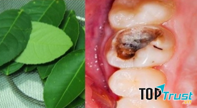 Lá chanh trị nhức răng