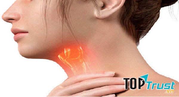 Ảnh minh họa - nguồn internet