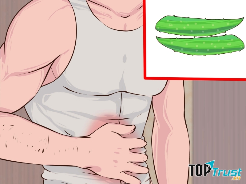 Nha đam có thể chữa được viêm loét dạ dày