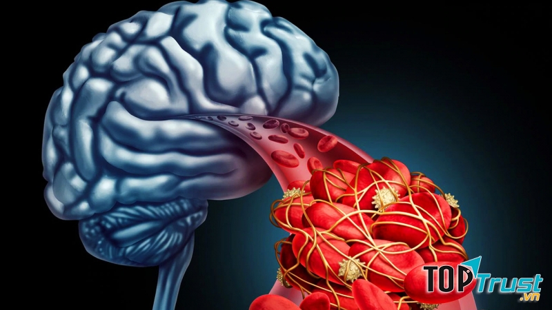 Ảnh hưởng đến não