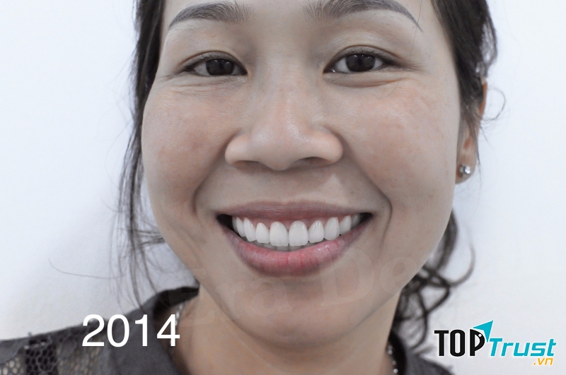 Trung Tâm Chỉnh Nha Sài Gòn ERA Dental