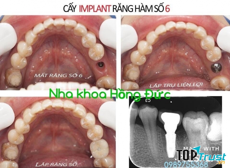 Trung Tâm Nha Khoa Hồng Đức