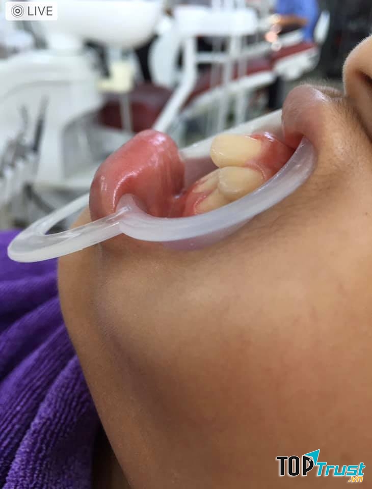 Trung Tâm Nha Khoa Hồng Đức