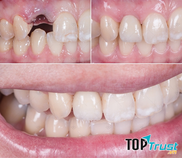 Trung Tâm Nha Khoa Thẩm Mỹ Châu Thành