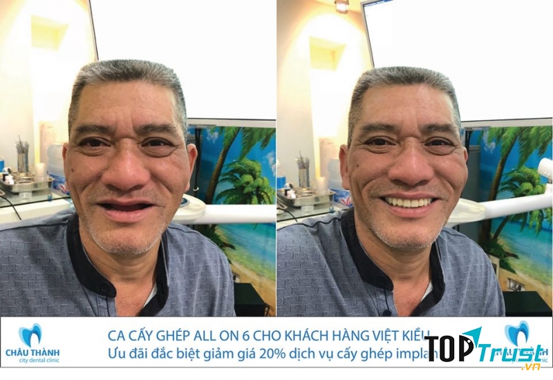 Trung Tâm Nha Khoa Thẩm Mỹ Châu Thành