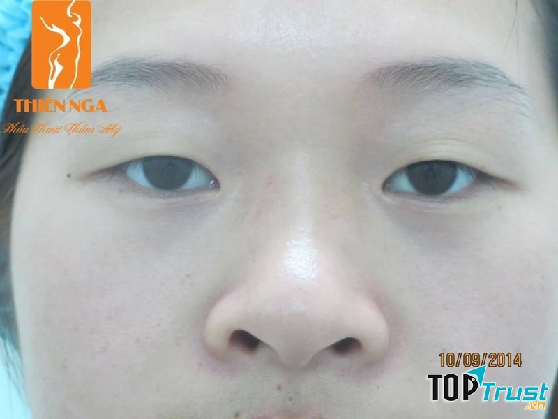 Trung tâm Phẫu thuật Thẩm mỹ Thiên Nga