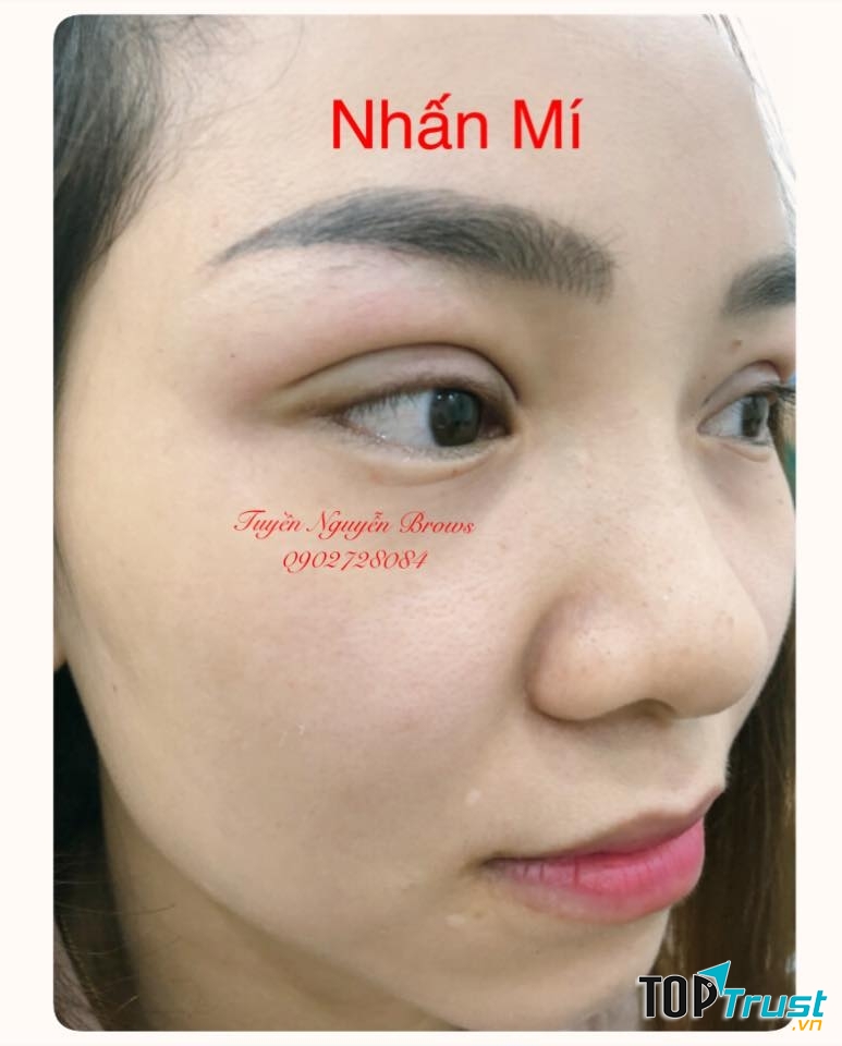 Tuyền Nguyễn Nhấn Mí