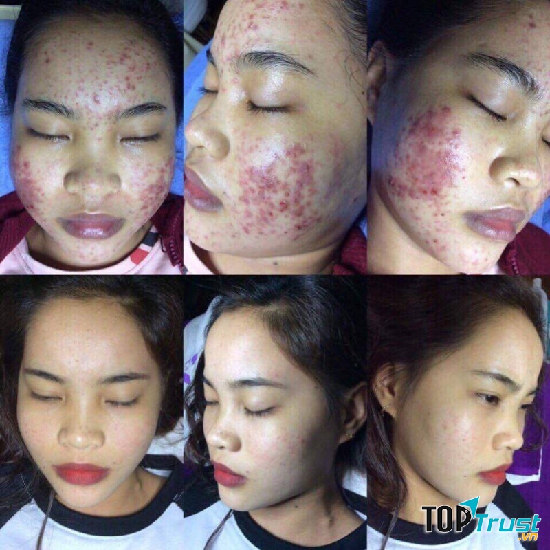 Thẩm Mỹ Viện Ula - Bình Dương