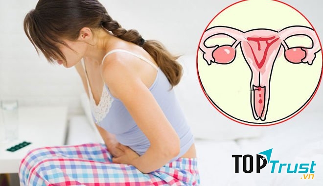 Ung thư cổ tử cung có thể tước đi thiên chức làm mẹ