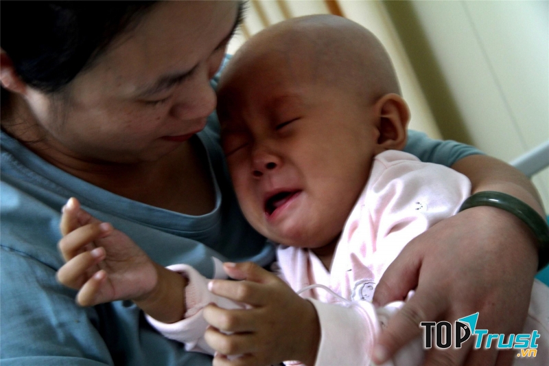 Bệnh này thường gặp ở những người bị nhiễm chất phóng xạ, hoặc ở trong môi trường quá ô nhiễm.