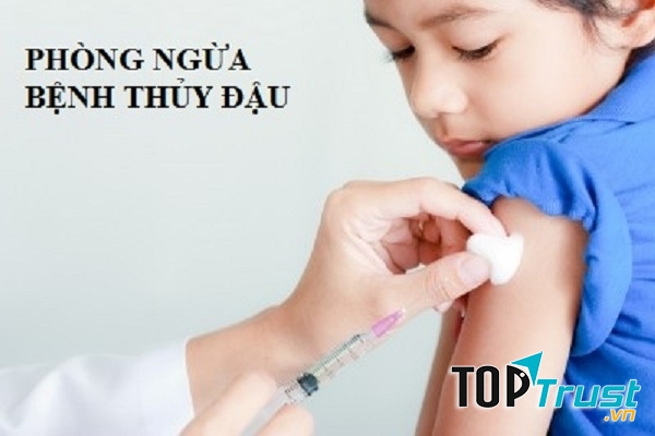 Vacxin ngừa thủy đậu