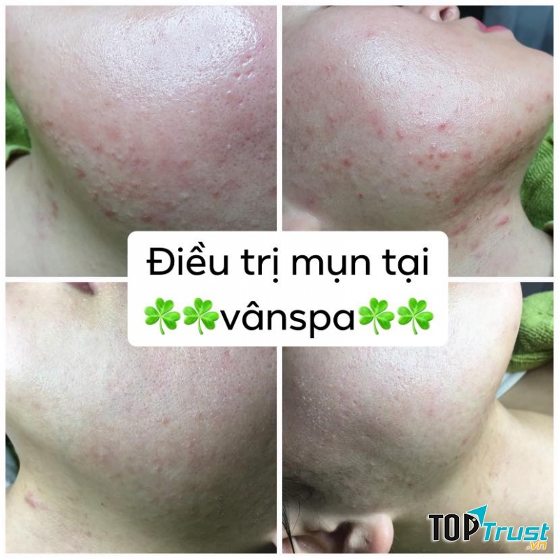 Vân Spa