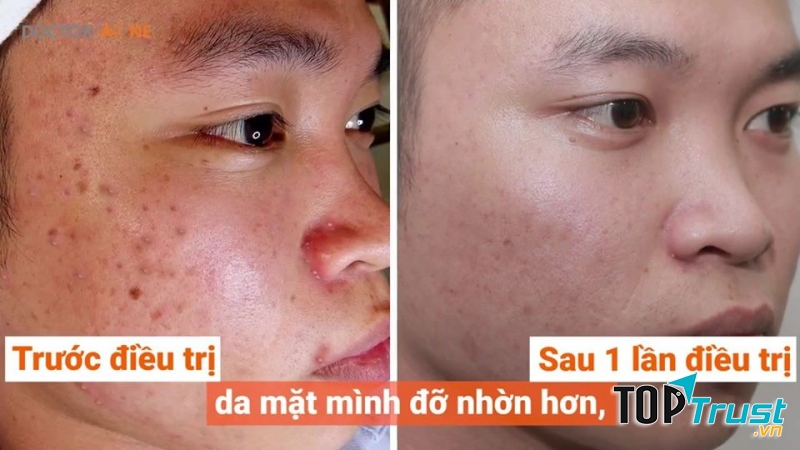 Vân Spa