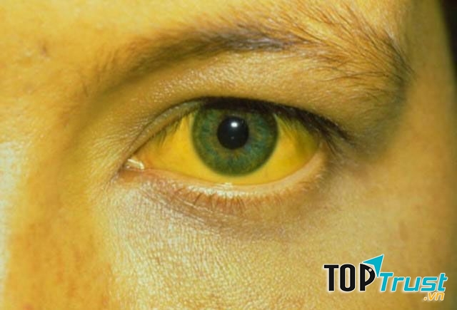 Ảnh minh họa - nguồn internet