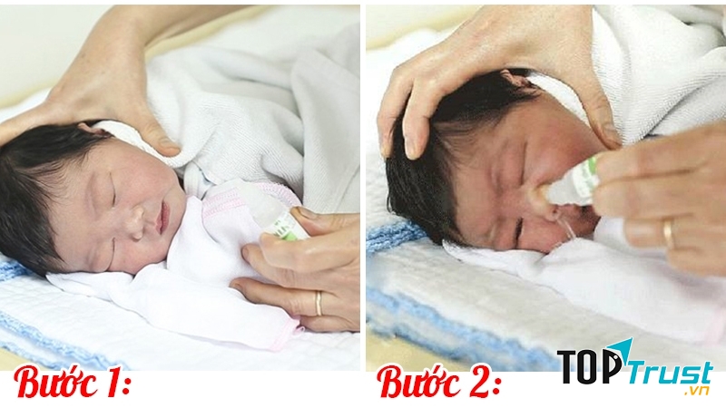 Các mẹ nên vệ sinh mũi cho con bằng dung dịch nước muối sinh lí.